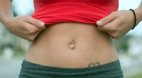 Малоинвазивный (щадящий) метод лечения грыж погружаемыми швами (без швов на коже)​