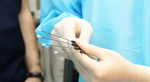 Биопсия предстательной железы: современные подходы и методики