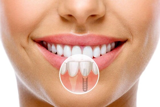 Dentistry Promotions! Dentistry Promotions!